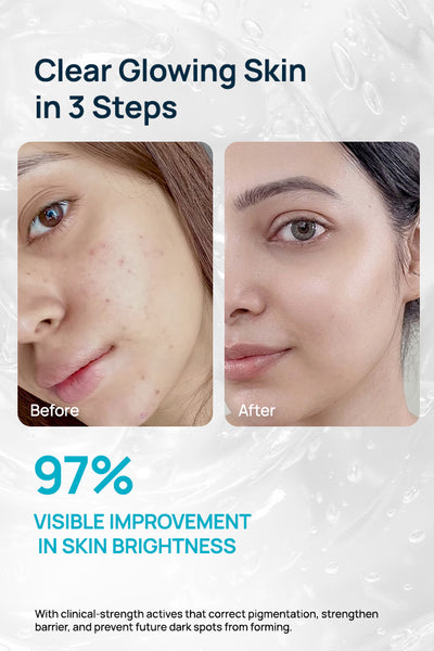 Dark Spots Combo Routine