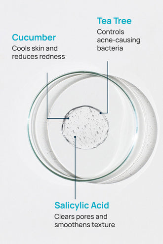 Acne-Limit Facial Toner With 0.1% Cucumber Extract & 0.1% Tea Tree Extract