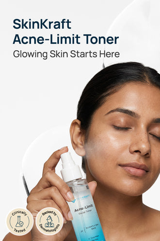 Acne-Limit Facial Toner With 0.1% Cucumber Extract & 0.1% Tea Tree Extract