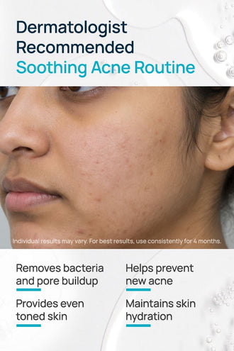 Acne-Limit Facial Toner With 0.1% Cucumber Extract & 0.1% Tea Tree Extract
