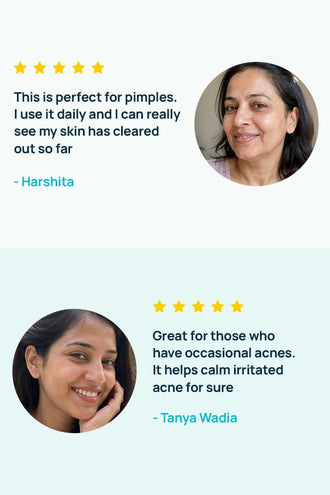 Acne-Limit Facial Toner With 0.1% Cucumber Extract & 0.1% Tea Tree Extract