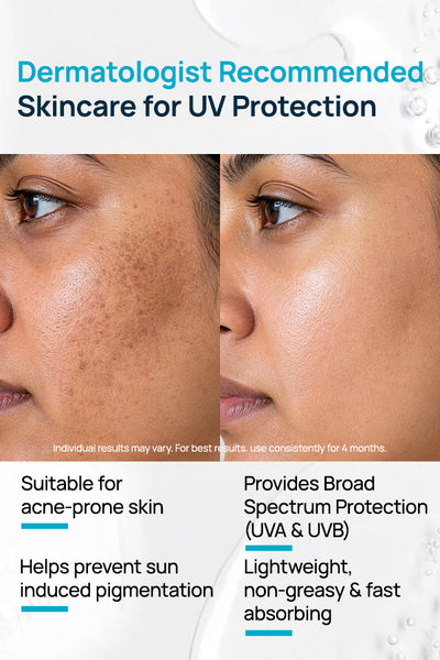 AcneShield Sunscreen SPF 50 PA++++ With 4% Niacinamide & 1% Salicylic Acid