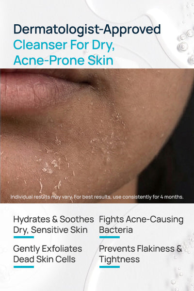 AcneShield Facial Cleanser For Dry Skin