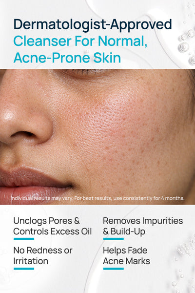 AcneShield Facial Cleanser For Normal SKin