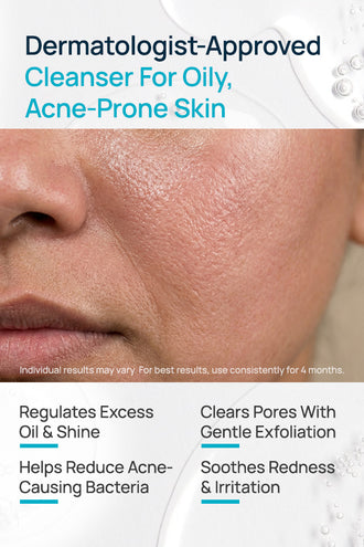 AcneShield Facial Cleanser With 0.1% Glycolic Acid & 0.1% Neem