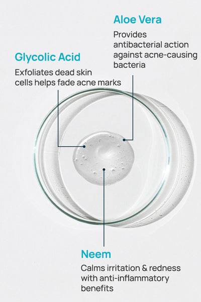 Acne Shield Facial Cleanser For Oily Skin