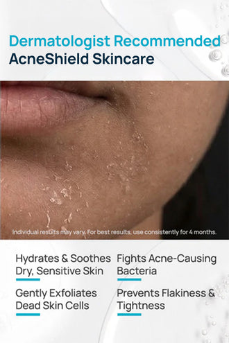 AcneShield Facial Cleanser With 0.1% Aloe Vera & 0.1% Willow Bark