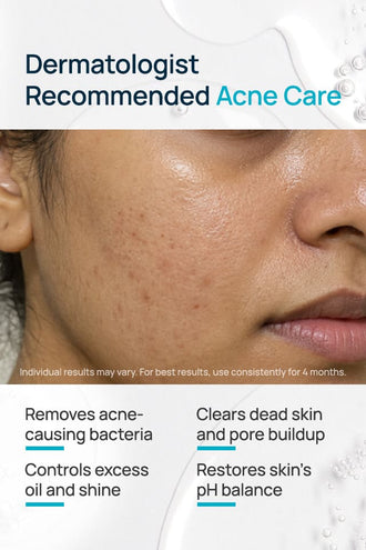 Acne Shield Facial Toner With 0.1% Cucumber Extract & 0.1% Tea Tree Extract