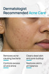 Acne Shield Facial Toner With 0.1% Cucumber Extract & 0.1% Tea Tree Extract
