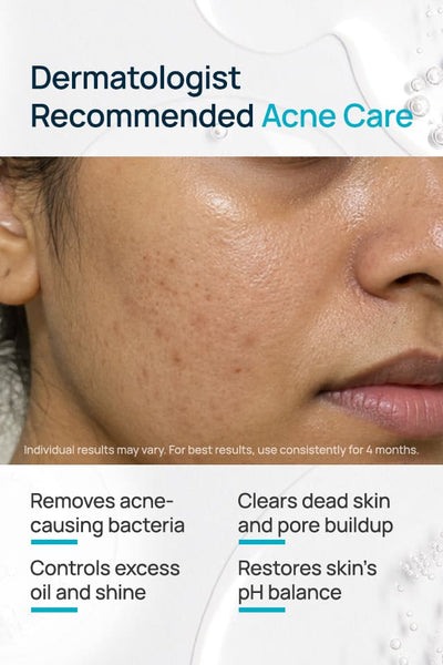 Acne Shield Facial Toner With 0.1% Cucumber Extract & 0.1% Tea Tree Extract
