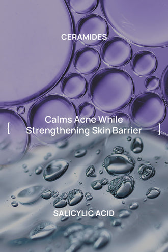 Acne Control Combo With 0.1% Tea Tree Extract and 1% Ceramides For Oily Skin