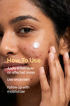 Acne Exfoliating Facial Cream For Women