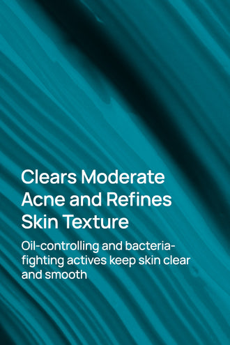 Acne-Limit Facial Cream With 9% Azelaic Acid & 4% Niacinamide