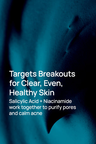 Salicylic Acid And Niacinamide Anti-Acne Face Mask With 1% Salicylic Acid & 2% Niacinamide