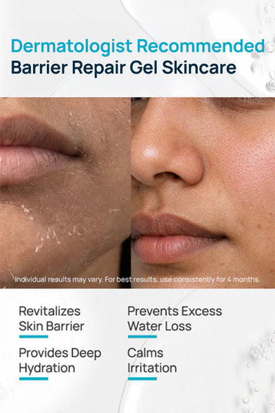 Barrier Repair Gel Regimen With Moisturizer & Cleanser
