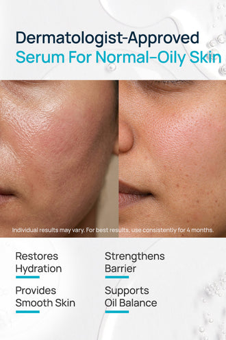 Barrier Repair Serum With 3% Propanediol & 1% Ceramides