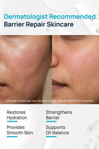 Barrier Repair Serum With 3% Propanediol & 1% Ceramides