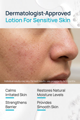 Barrier Restorative Lotion With 0.5% Shea Butter & 1% Ceramides