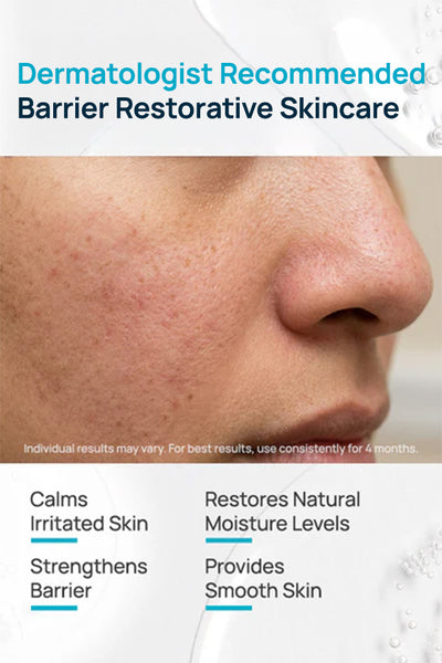 Barrier Restorative Lotion With 0.5% Shea Butter & 1% Ceramides