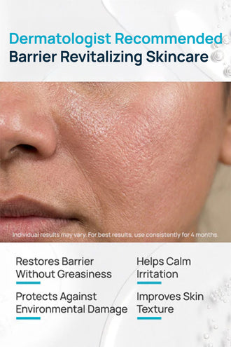 Barrier Revitalizing Lotion With 0.5% Phytospingosine & 1% Ceramides