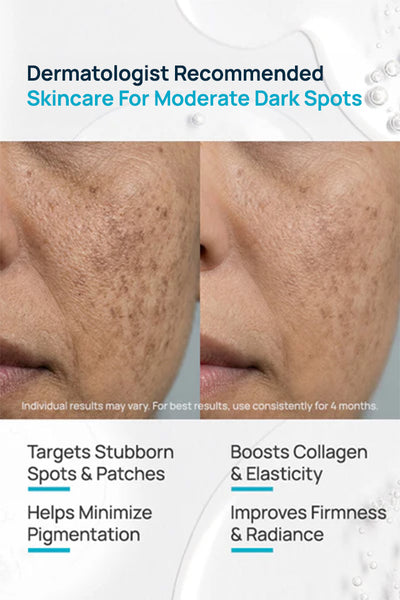Dark Spot Brightening Regimen With Serum & Cleanser