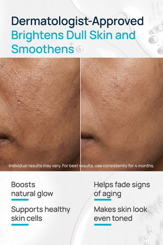 BrightSide Facial Serum With 5% Niacinamide & 1% Vitamin C