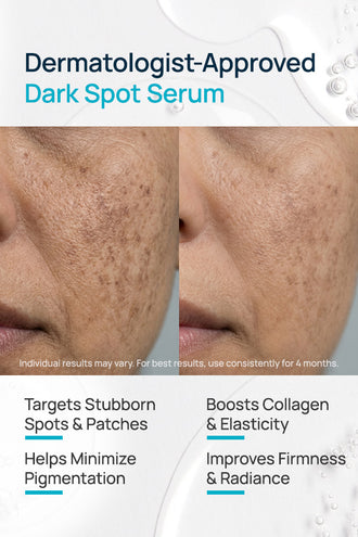 Dark Spot Brightening Facial Serum With 4% Niacinamide & 1% Alpha Arbutin