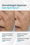 Dark Spot Brightening Facial Serum For Women