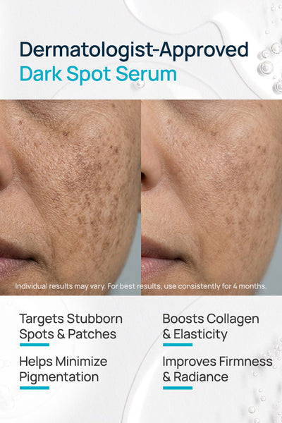 Dark Spot Brightening Facial Serum For Women