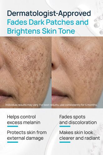 Niacinamide With Licorice Depigmentation Serum With 4% Niacinamide & 1% Vitamin C