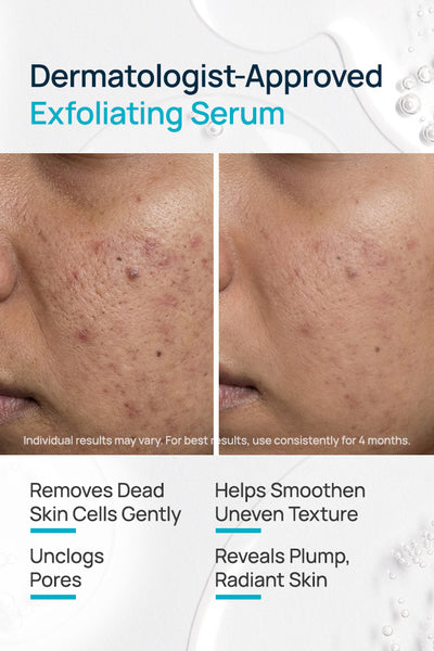 Re-Texturizing Facial Serum For Dull and Uneven Skin
