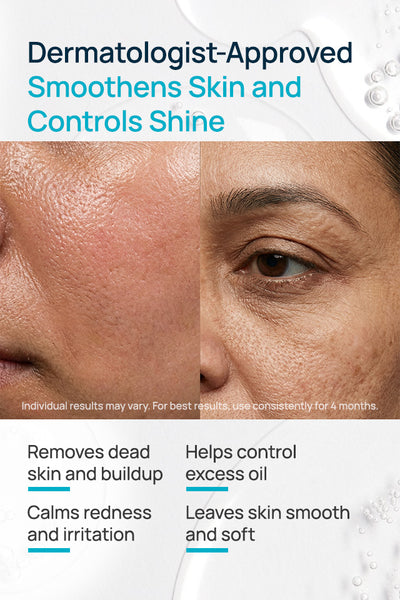 De-Grease Mattifying Face Scrub