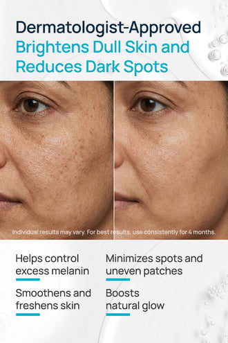 Alpha Arbutin Gleam On Facial Mask With 0.5% Alpha Arbutin & 0.5% Vitamin E