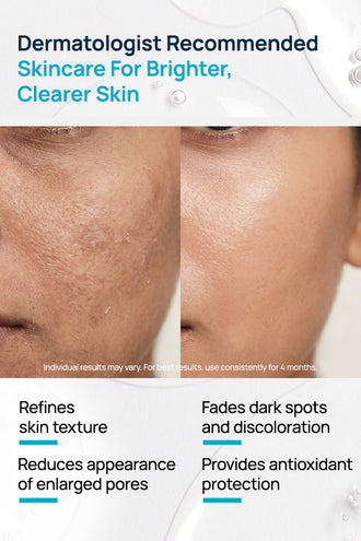 BrightSide Night Cream With 4% Niacinamide & 2% Vitamin C