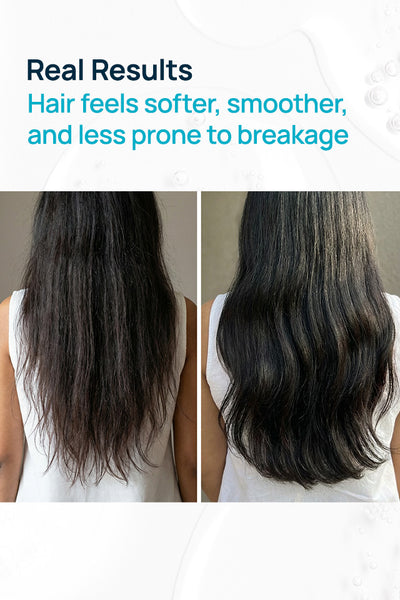 Scalp Quench Hairfall Oil With 0.5% Jojoba & 1% Almond