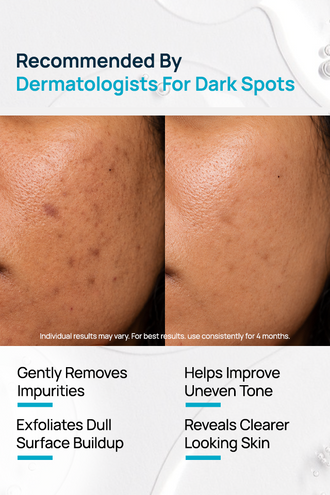 Oligopeptide 68 Dark Spot Clarifying Facial Cleanser With Niacinamide & Rice Water