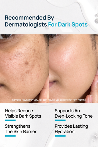 Oligopeptide 68 Dark Spot Reset Moisturizer With Ceramides & Hyaluronic Acid