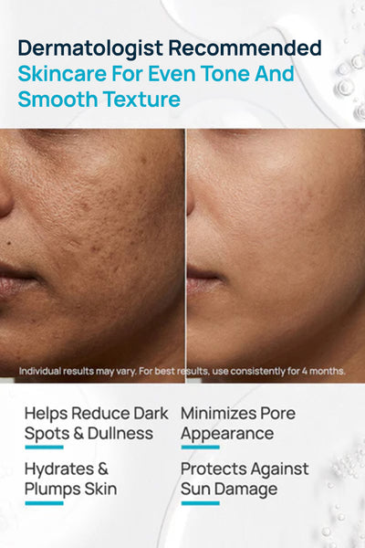 Pore-Free Regimen With Serum, Cleanser & Moisturizer