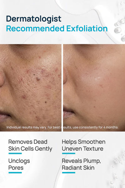 Re-Texturizing Regimen With Serum, Cleanser & Moisturizer