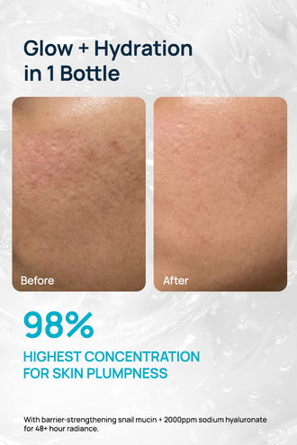 Advanced 98% Snail Mucin Hydrating Serum With 2% Snail Secretion Filtrate & 0.2% Sodium Hyaluronate