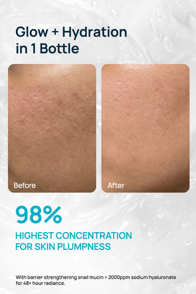 Advanced 98% Snail Mucin Hydrating Serum
