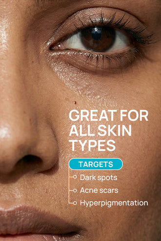 Dark Spot Combo With 2% Kojic Dipalmitate and 15% Glycerin For Normal Skin