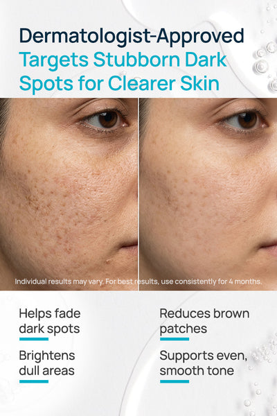 Correxion Spot Rectifying Facial Serum For Women