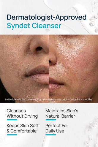 Syndet Face Cleanser With 15% Glycerin & 0.5% Polyquatermiun 22