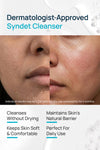 Syndet Face Cleanser For Women