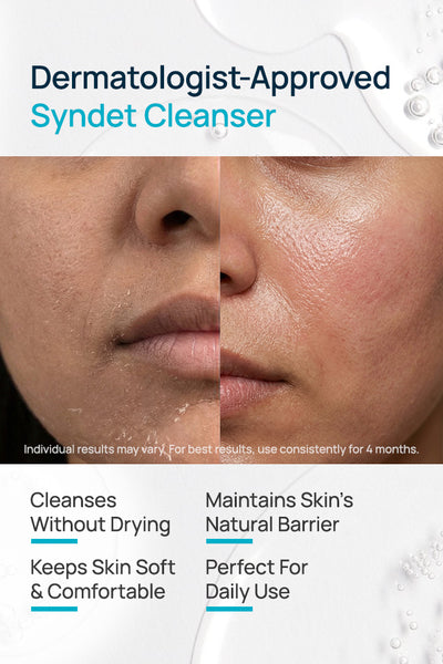 Syndet Face Cleanser For Women
