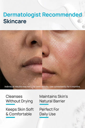 Syndet Face Cleanser With 15% Glycerin & 0.5% Polyquatermiun 22