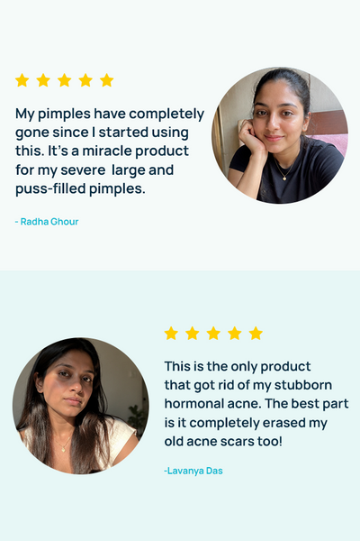 Acne Exfoliating Regimen With Serum & Cleanser
