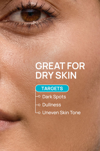 Glow Renewal Combo With 5% Niacinamide and 1% Vitamin C For Dry Skin