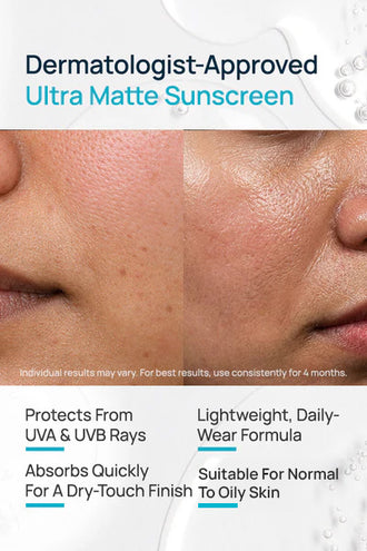 Ultra Matte Sheer Crème Gel SPF 40 PA+++ Sunscreen With 0.5% Vitamin C
